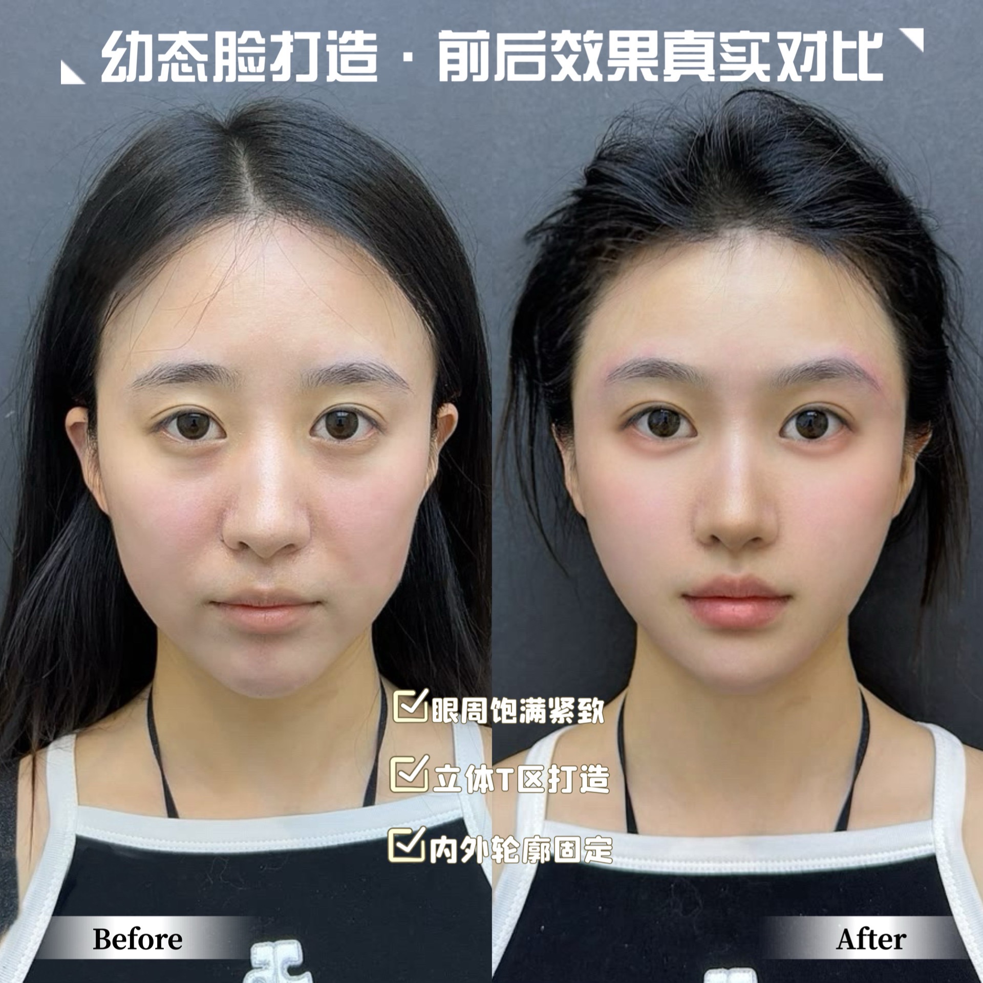 想打造幼态脸的姐妹看过来，哪里做幼态脸更靠谱(图1)