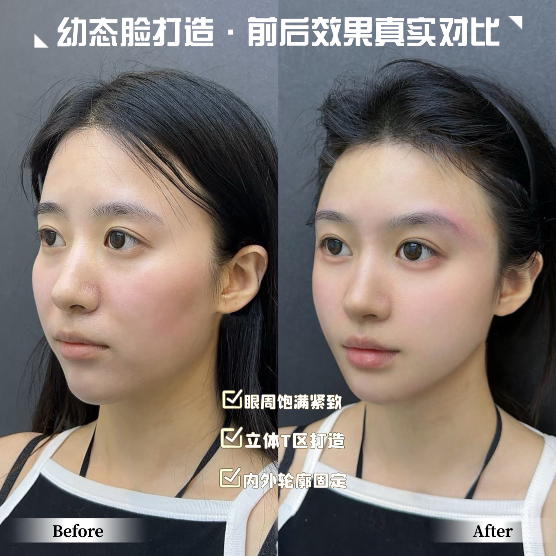 上海哪里做幼态脸做的好 多少钱