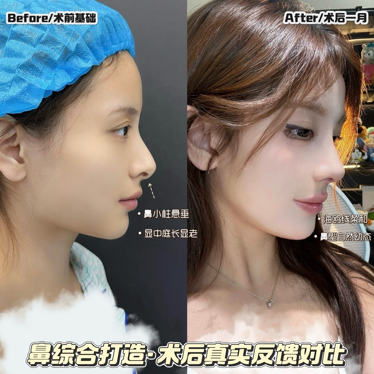追求一种幼态的年轻美是大多数求美者的追求