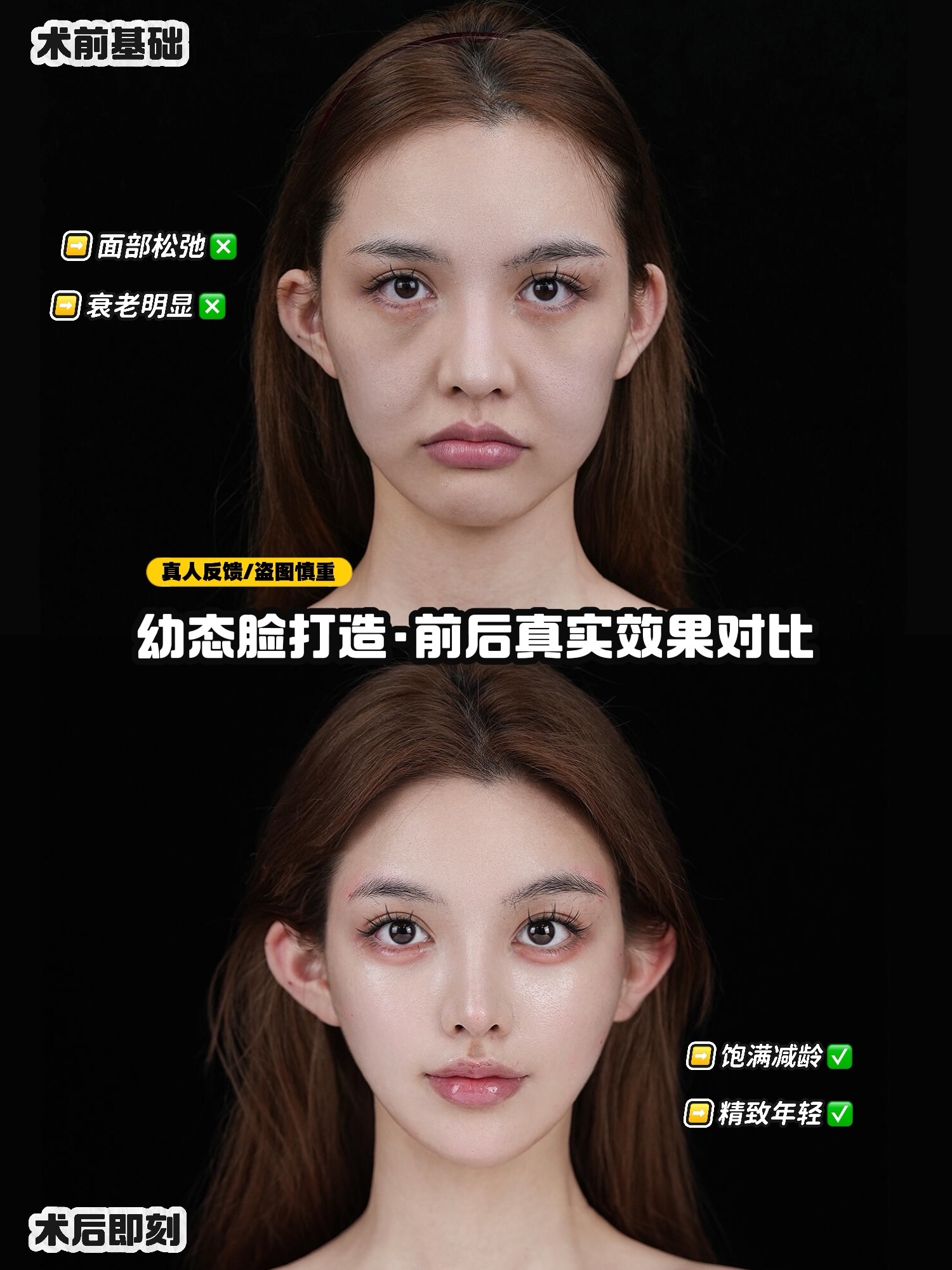 幼态脸需要做哪些项目?分享拥有幼态脸可做的6种整形项目