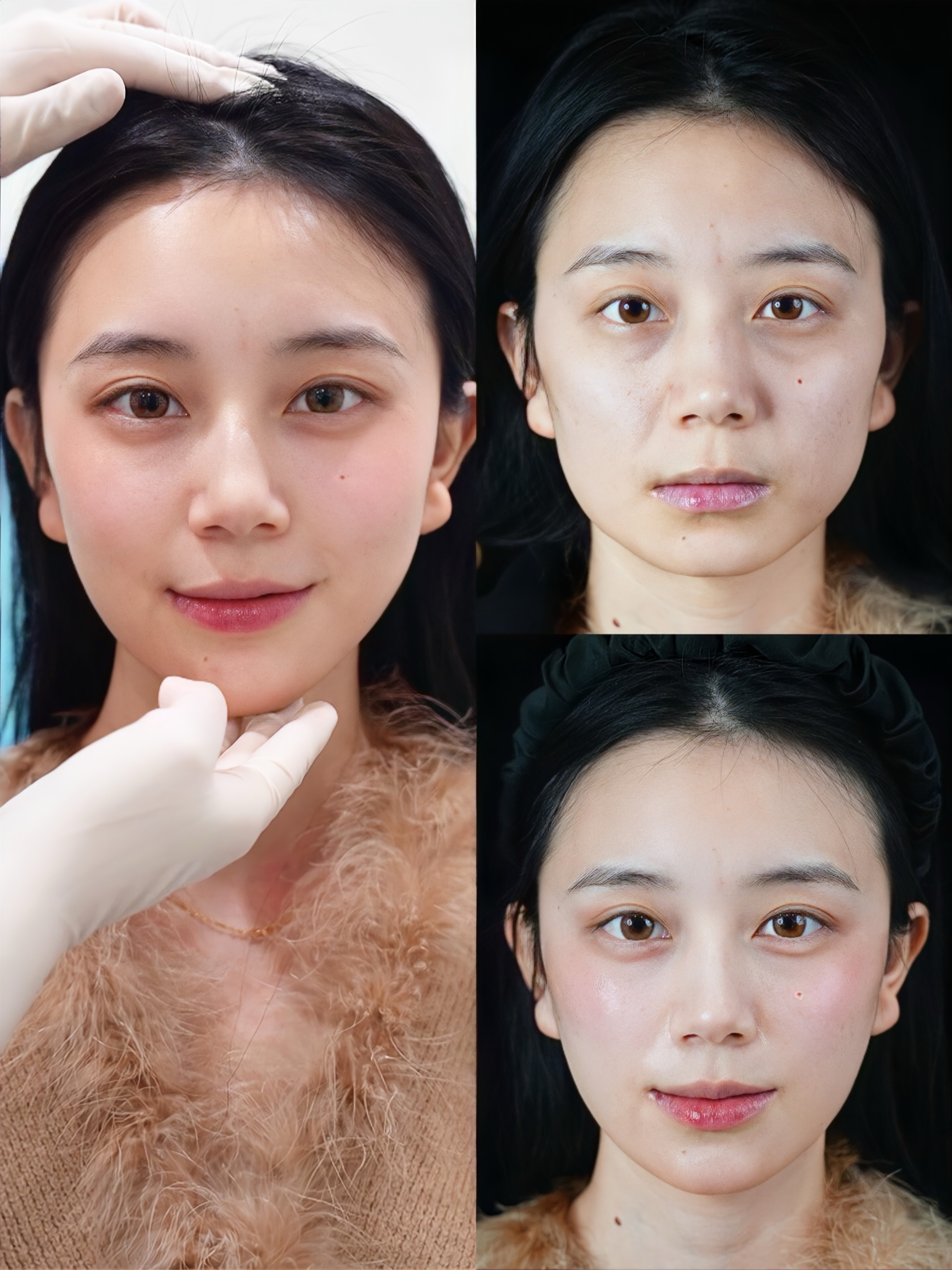 想打造幼态脸的姐妹看过来！打造幼态脸到底靠谱吗？