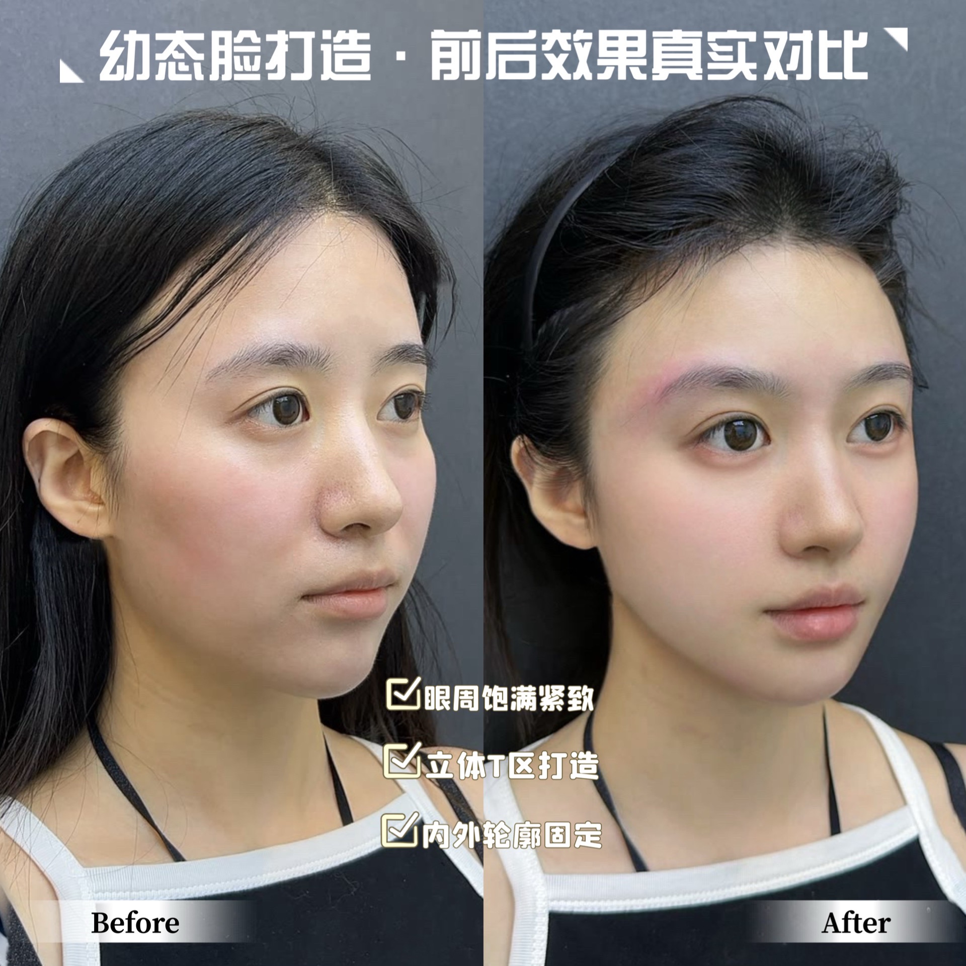 幼态脸越来越受欢迎！普通人怎么微调才能更显幼态(图5)