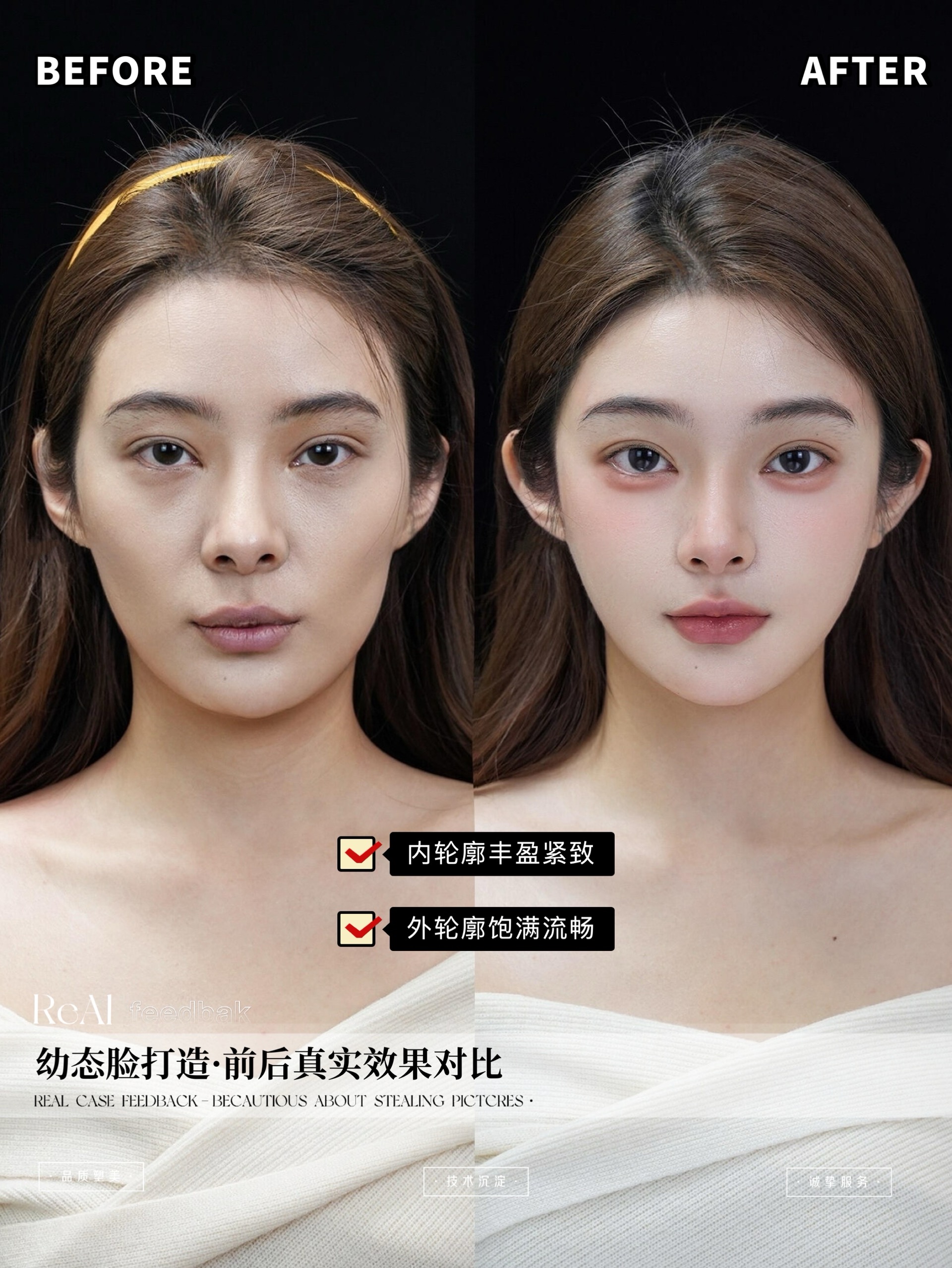 哪个医生做幼态脸做的好 怎么收费(图4)
